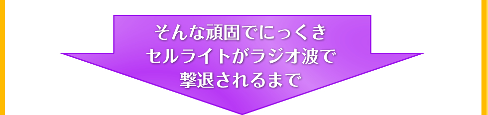 セルライトがラジオ派で撃退されるまで