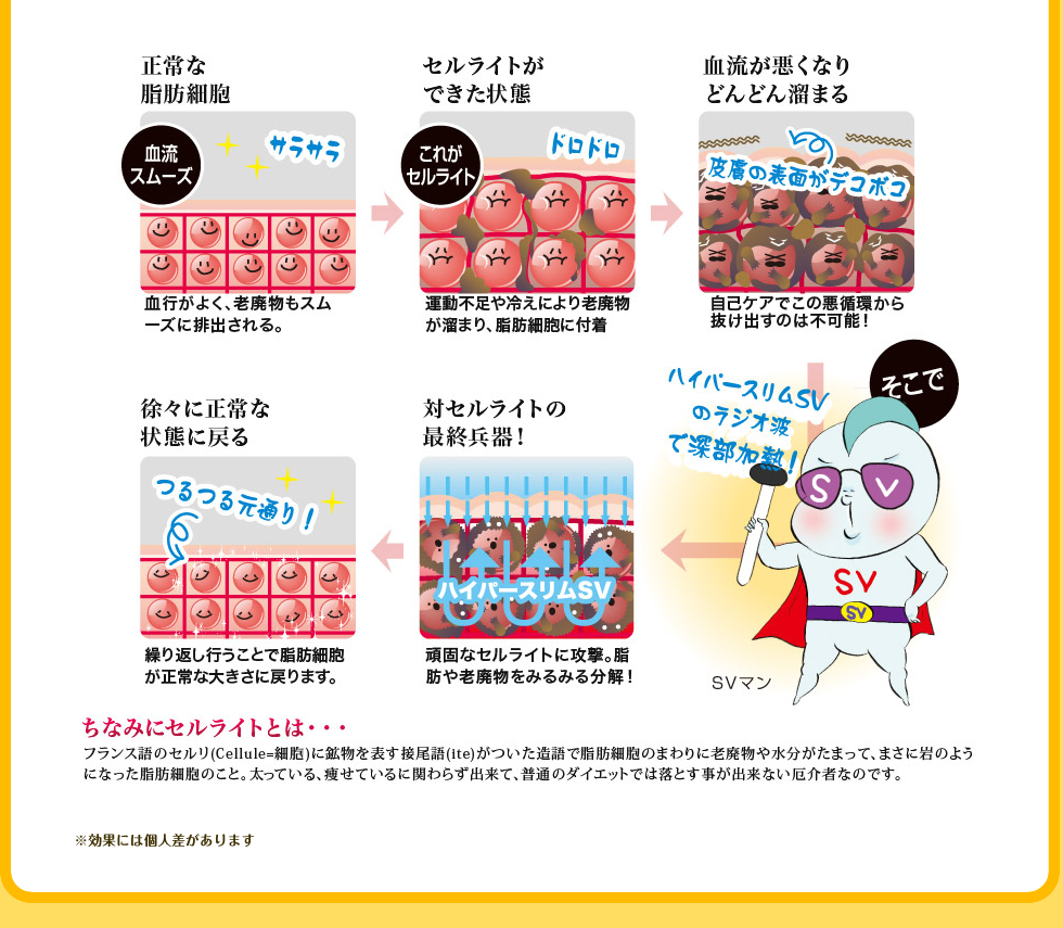 ハイパースリムSVのラジオ波で深部加熱！