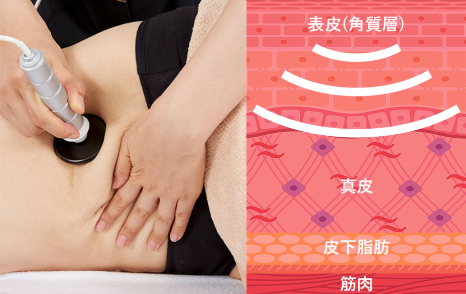 ハイパースリムSV