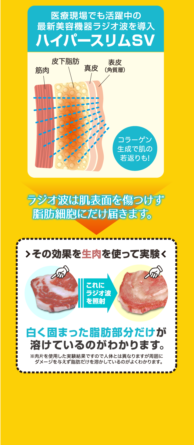 ハイパースリムSV