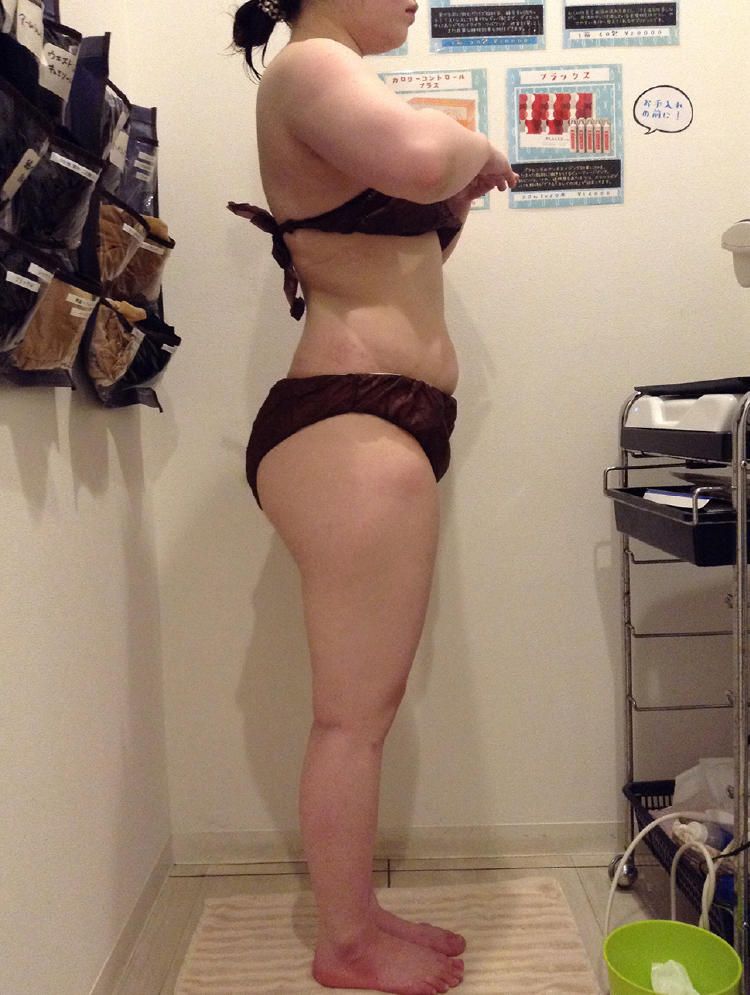 ビフォアアフター