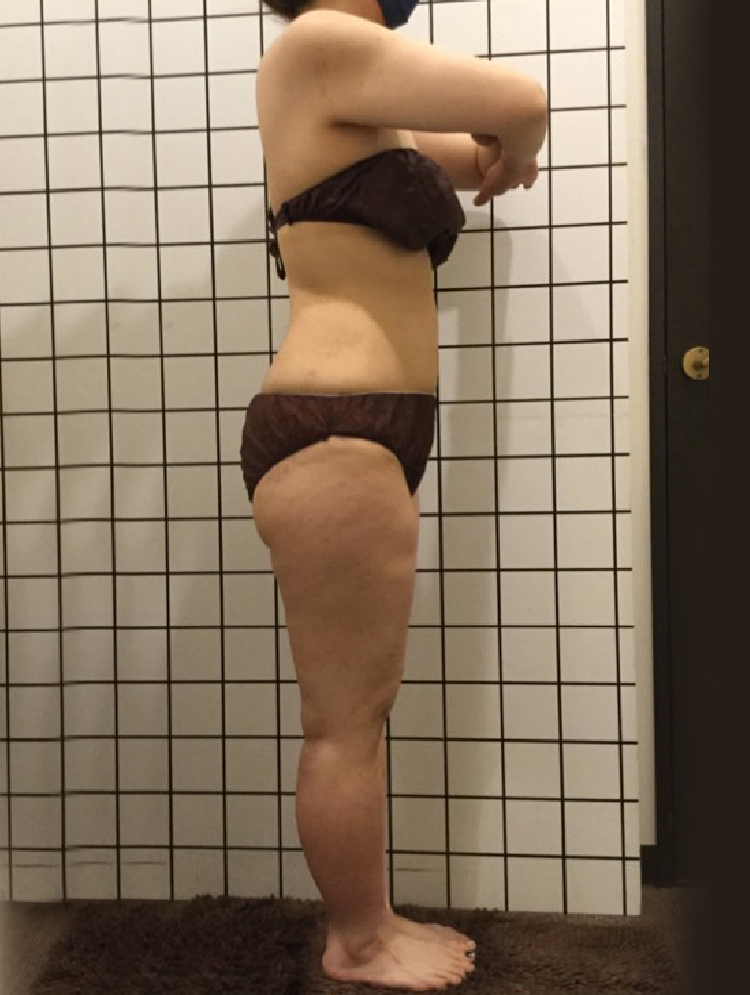 ビフォアアフター