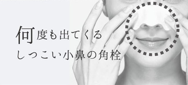 しつこい小鼻の角栓
